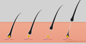 Ilustração indicando as fases anágena, catágena e telógena do ciclo de vida dos cabelos