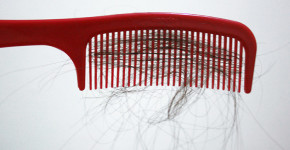 Fios de cabelo presos em pente, ilustrando artigo sobre efluvio telogeno