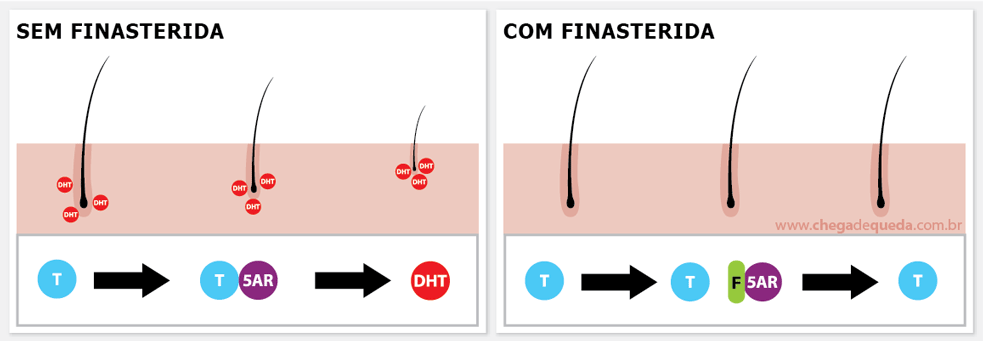 Ilustração de como a finasterida interfere na conversão da testosterona em dht
