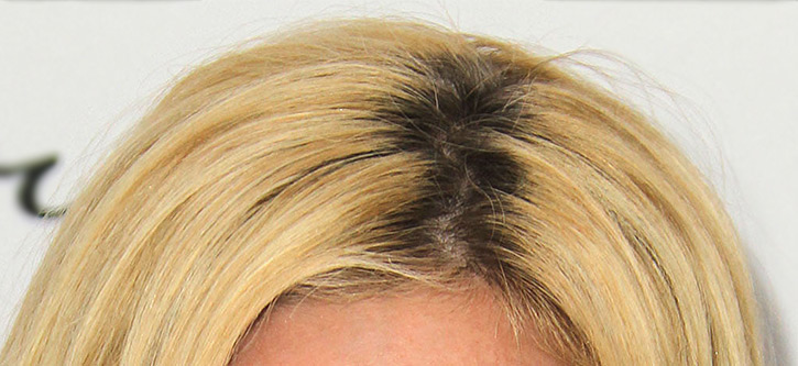 Raiz escura em cabelo tingido, ilustrando como avaliar resultados do Imecap Hair